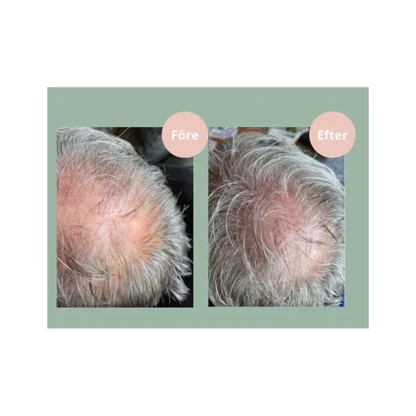 Hair Growth Balsam 250ml