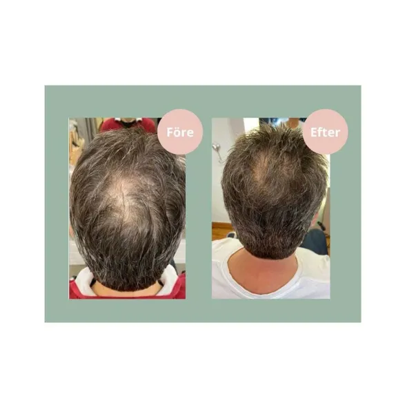 Hair Growth Schampo 250ml